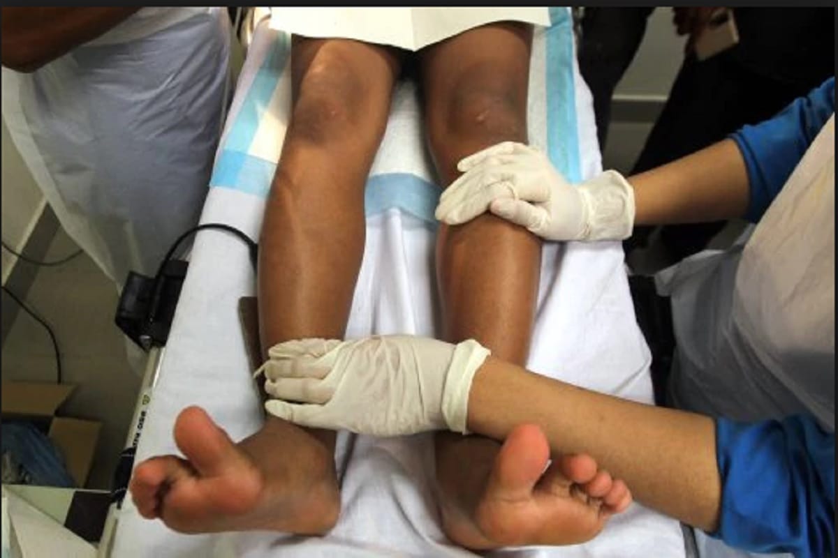 Supreme Court raises questions on circumcision of Muslim girls