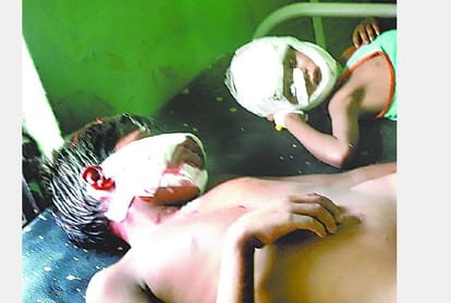 dogs attack in sitapur many injured.