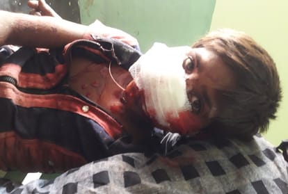 dogs attack in sitapur many injured.