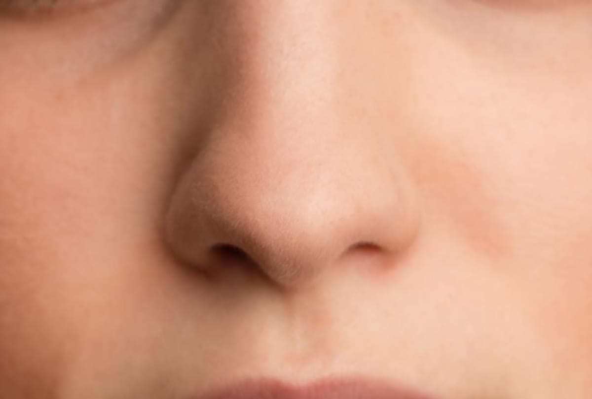 incident this woman sneezed out a ring that has been stuck in her nose for 12 years