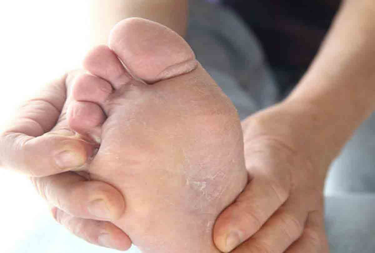 Increase the risk of fungal infections in the rainy season