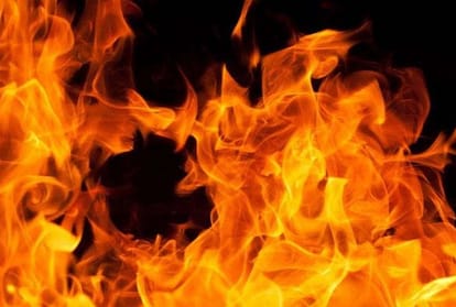 woman burnt her daughter in law