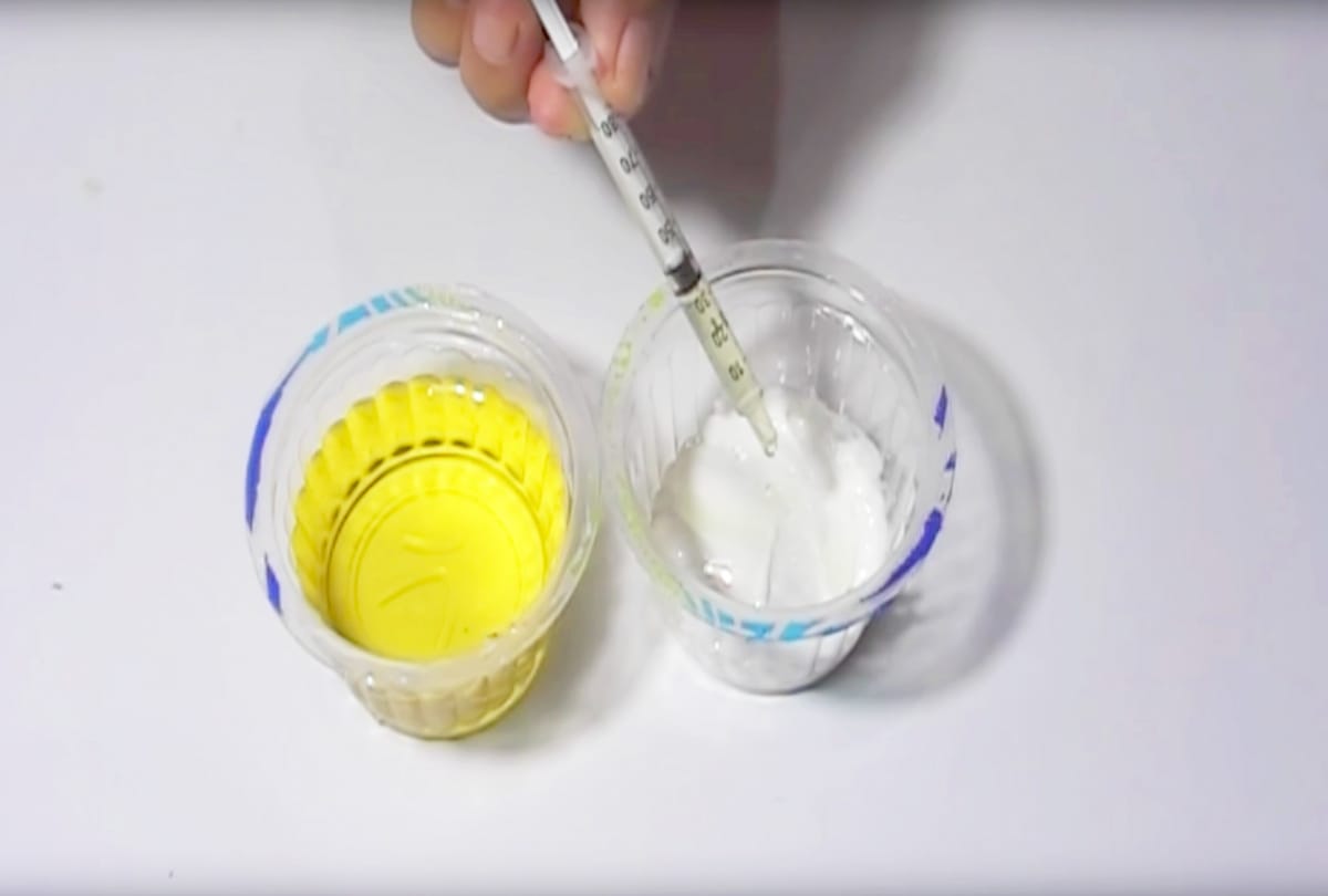 Ivf Technique Know Every Detail About This Process before pregnancy