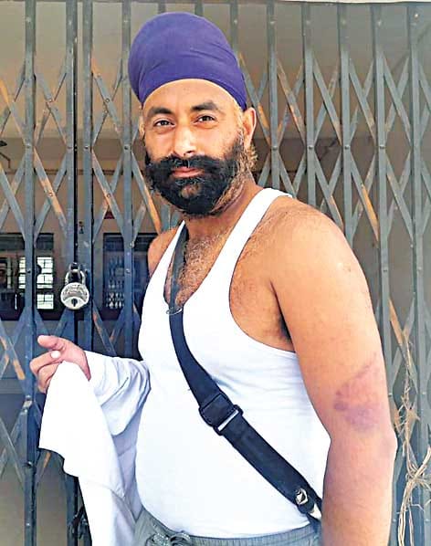 electric worker beaten