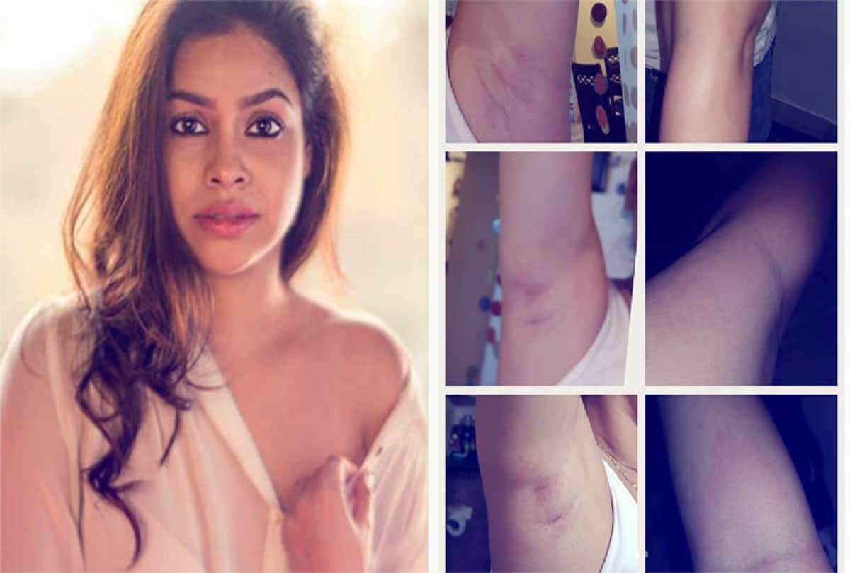 Sumona Chakravarti skin damage after waxing tips to remember when getting wax 