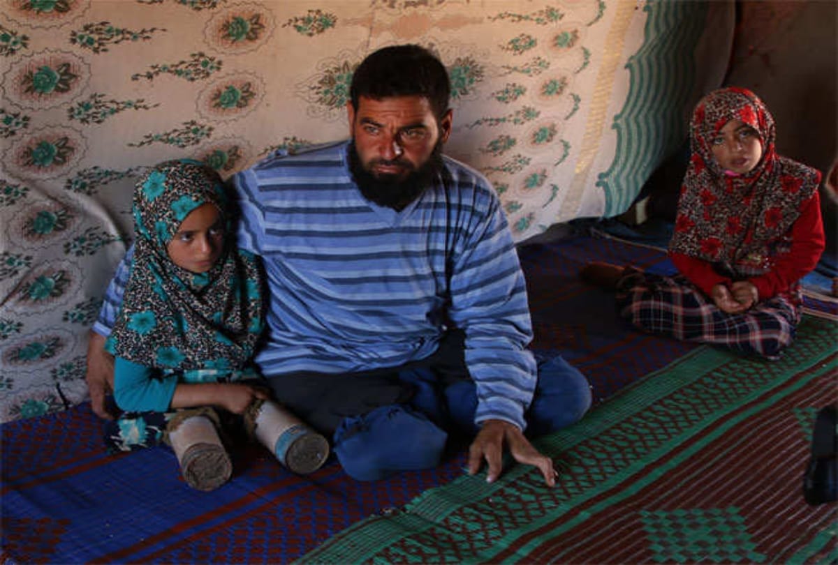 eight years old girl who used tin cans for legs in northern syria 