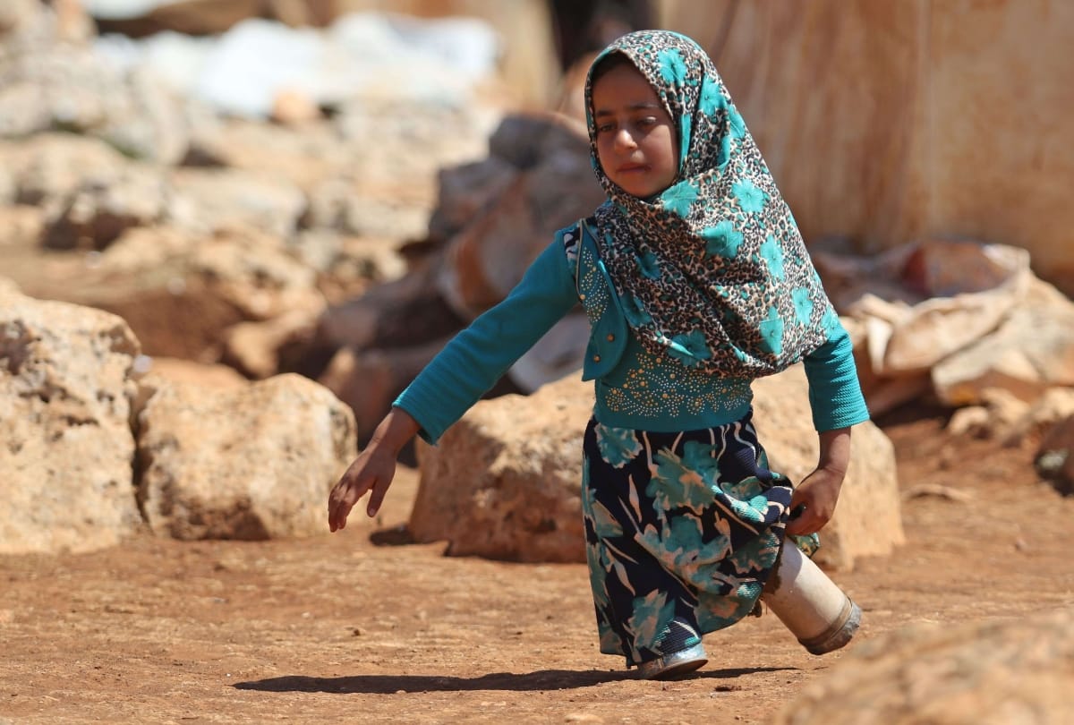 eight years old girl who used tin cans for legs in northern syria 
