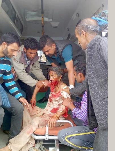 कपड़े धोने जा रही महिला पर भालू का हमला
