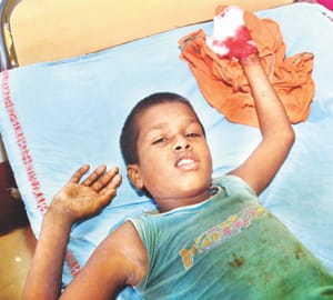 Bomb injured in temple complex; teen injured