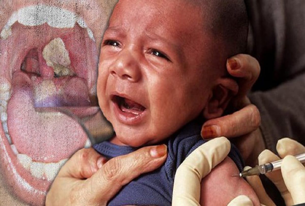 three children of one family of jammu kashmir reasi district suffering from Diphtheria one dead