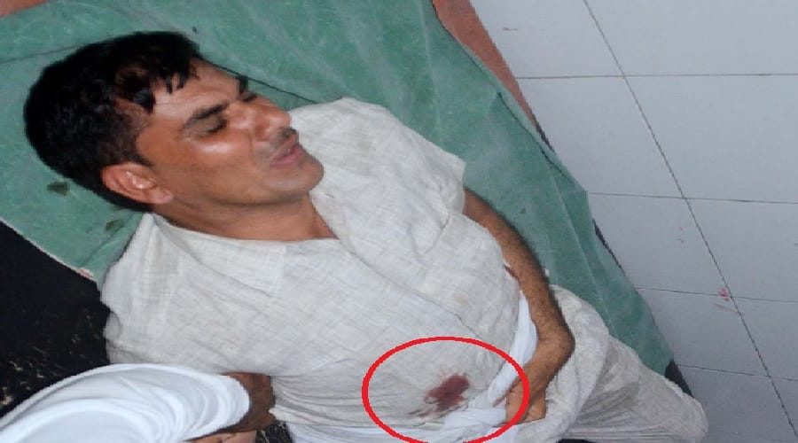 BSP former MLA's brother is shot, injured