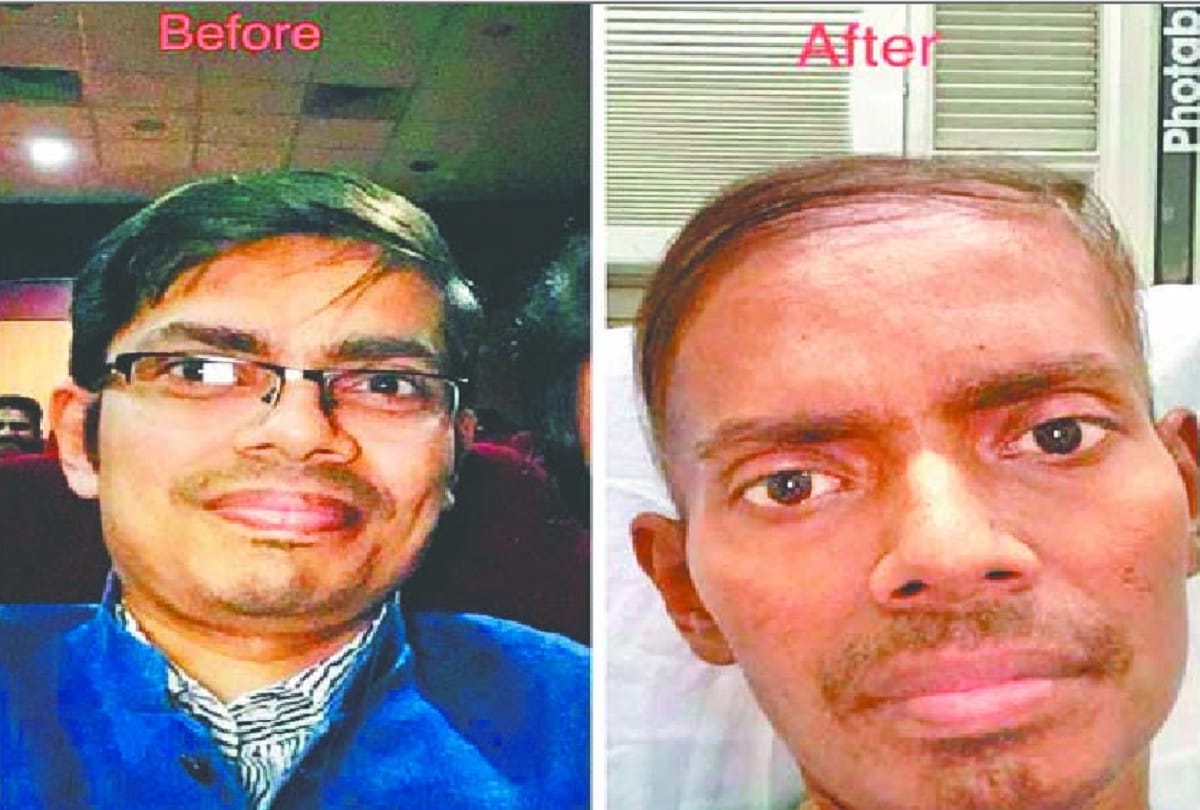 Safdarjung Hospital doctor seeks help for his own treatment