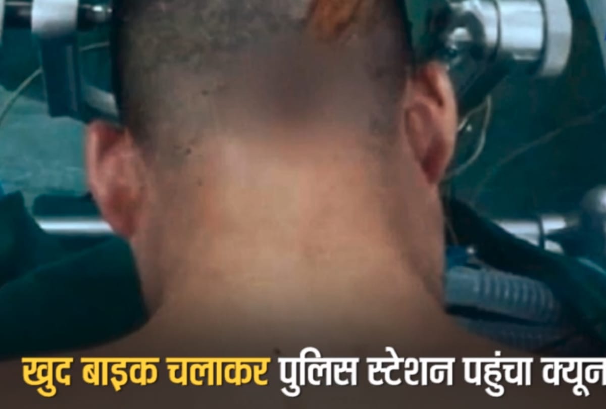 Man drive bike himself with Eight inches knife in his head arrived at police station