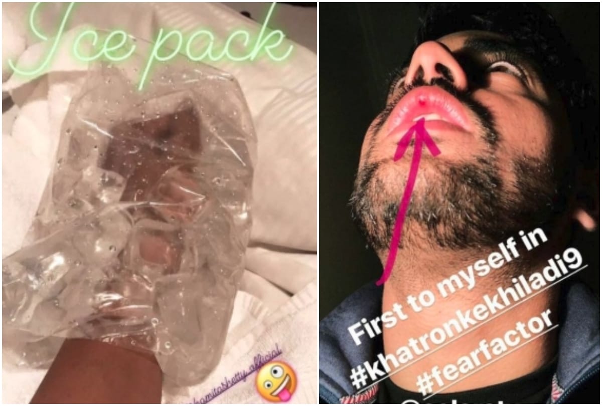 Vikas Gupta and Zain Imam injured while performing stunts on Khatron Ke Khiladi season 9
