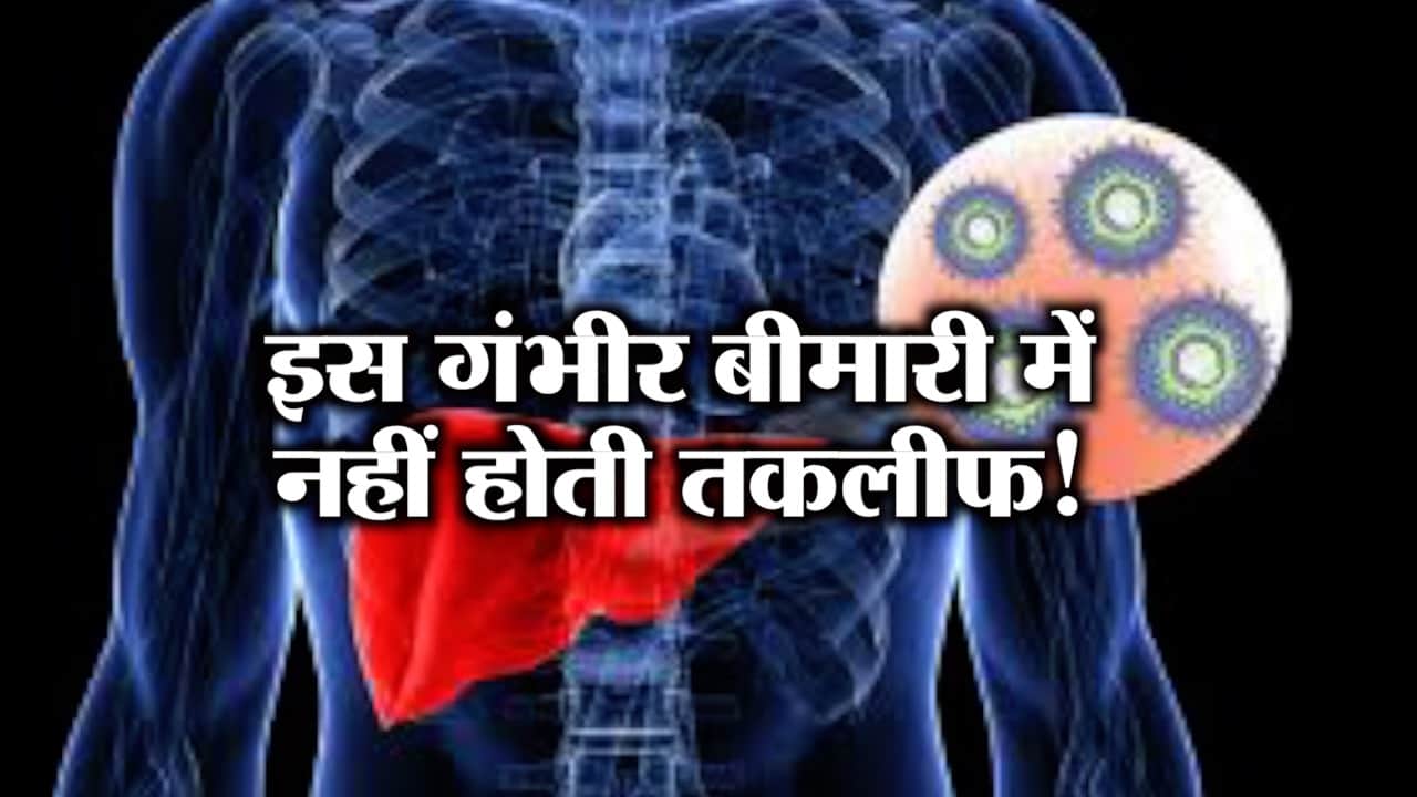 हेपेटाइटिस 