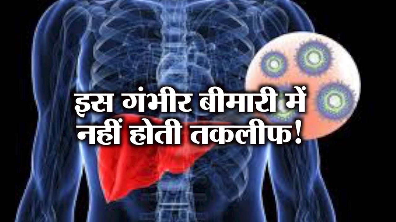 हेपेटाइटिस 