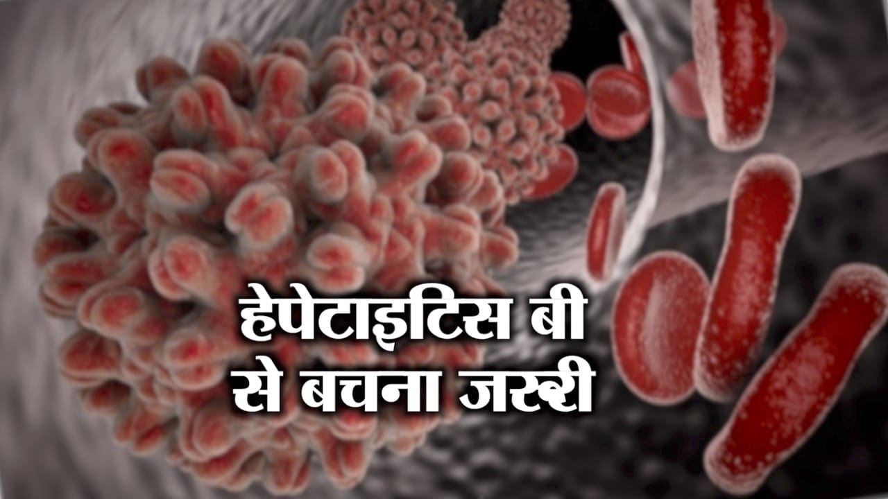 हेपेटाइटिस 