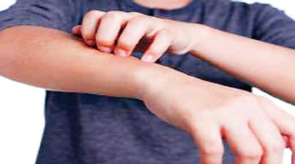Be careful in rain, otherwise infection will occur, pregnant women should take care of these things