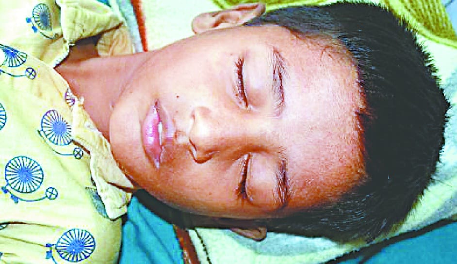 four children get ill after eating fish 