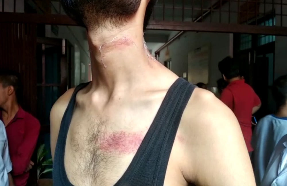 Attempt to kill the district hospital employee