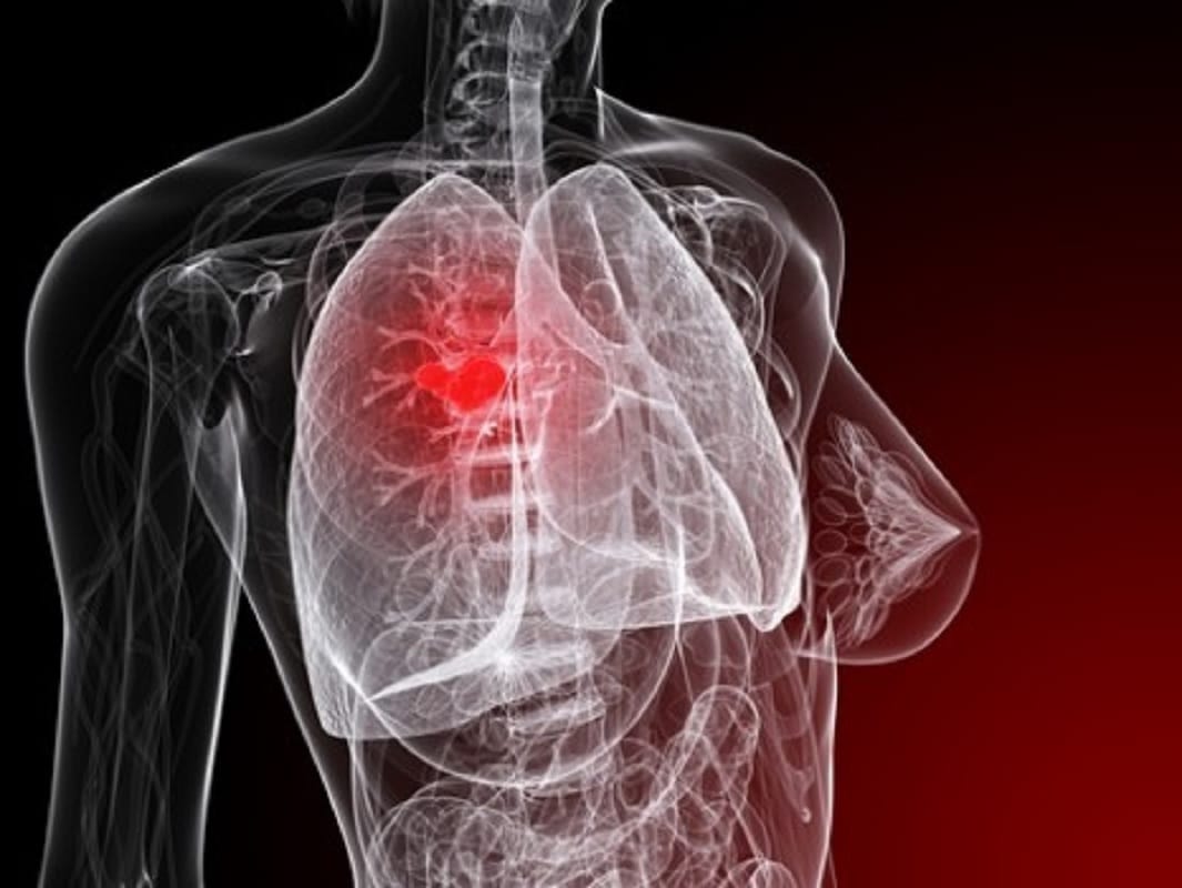 chance to change lungs of patients who became corona negative in gorakhpur