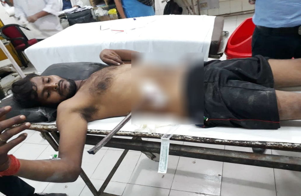 Iron rod entered in young man stomach after falling from roof