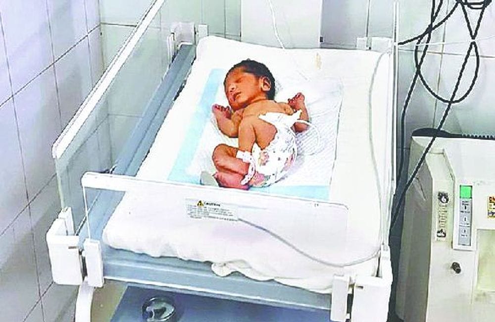 Newborn feet burn in hospital at Ghaziabad