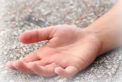Death of siblings from malnutrition