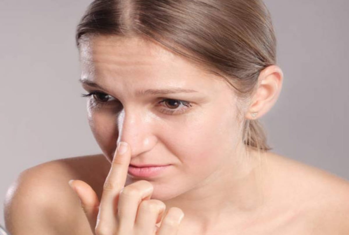 home remedies for remove blackheads