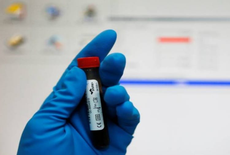  Only Rs 1,500 will be given to employees to Dope test