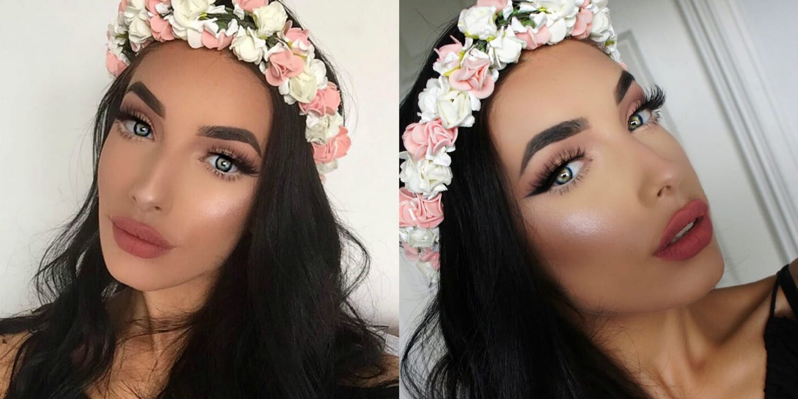 Snapchat dysmorphia in which people seek cosmetic surgery to look like their filtered selfie