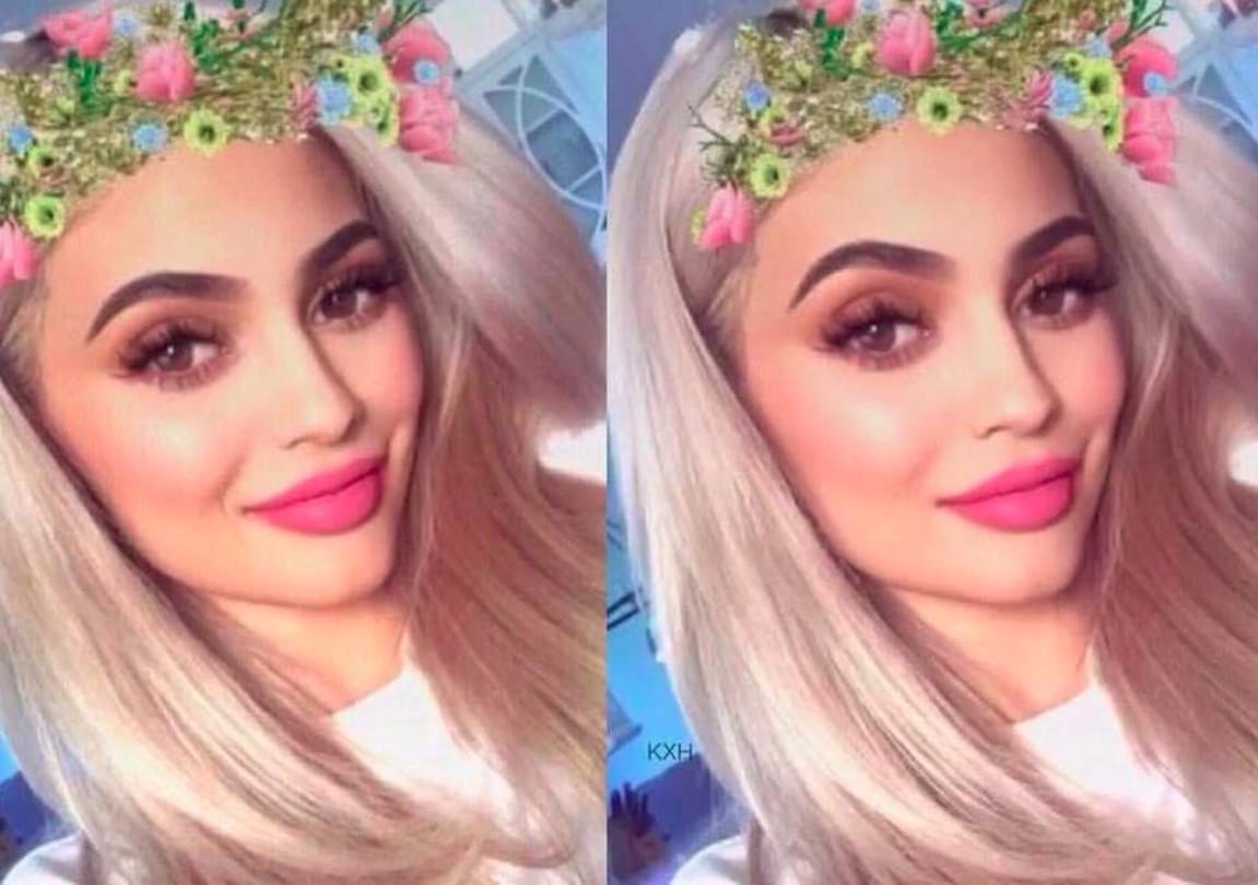 Snapchat dysmorphia in which people seek cosmetic surgery to look like their filtered selfie