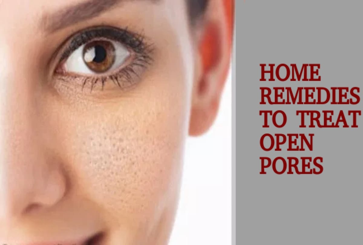 Home Remedies For Open Pores And tighten loose skin