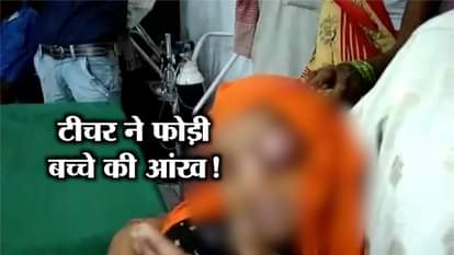 EYE OF LKG STUDENT DAMAGED DUE TO PUNISHMENT BY TEACHER IN SAHANJANPUR