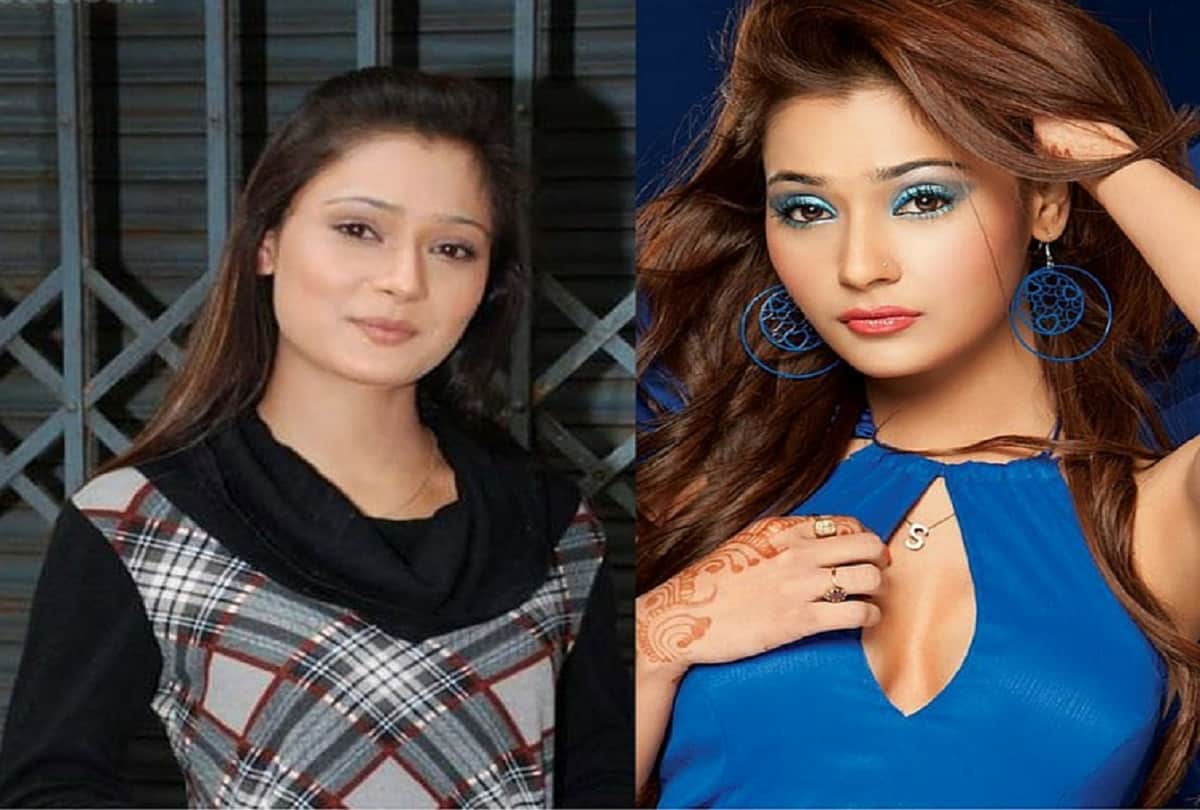 10 TV Actress Have Undergone Plastic Surgery See New Look
