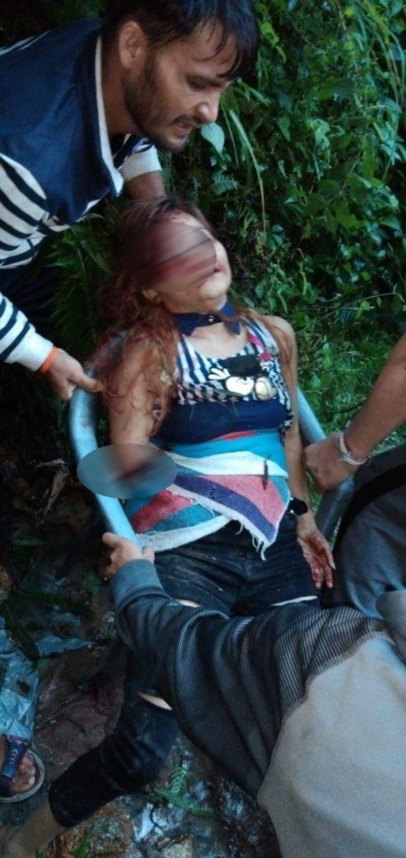 after major accident two friend show inhumanity