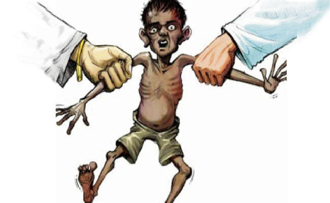 UP this district children suffred from malnutrition