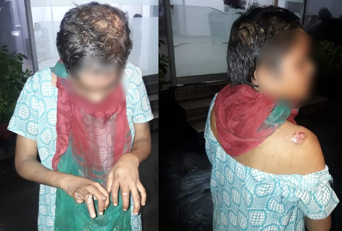 Rape and harassment with a teenager for two years in Lucknow