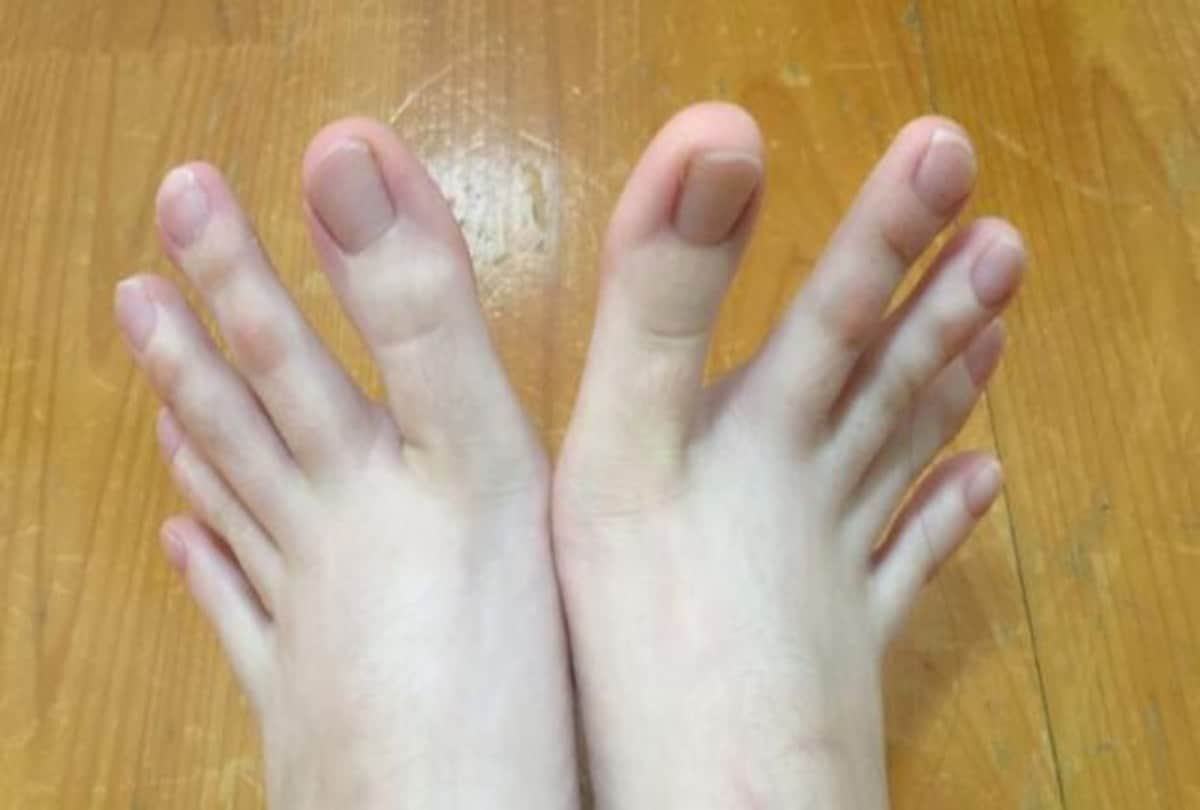 know about marks on your body determine your luck