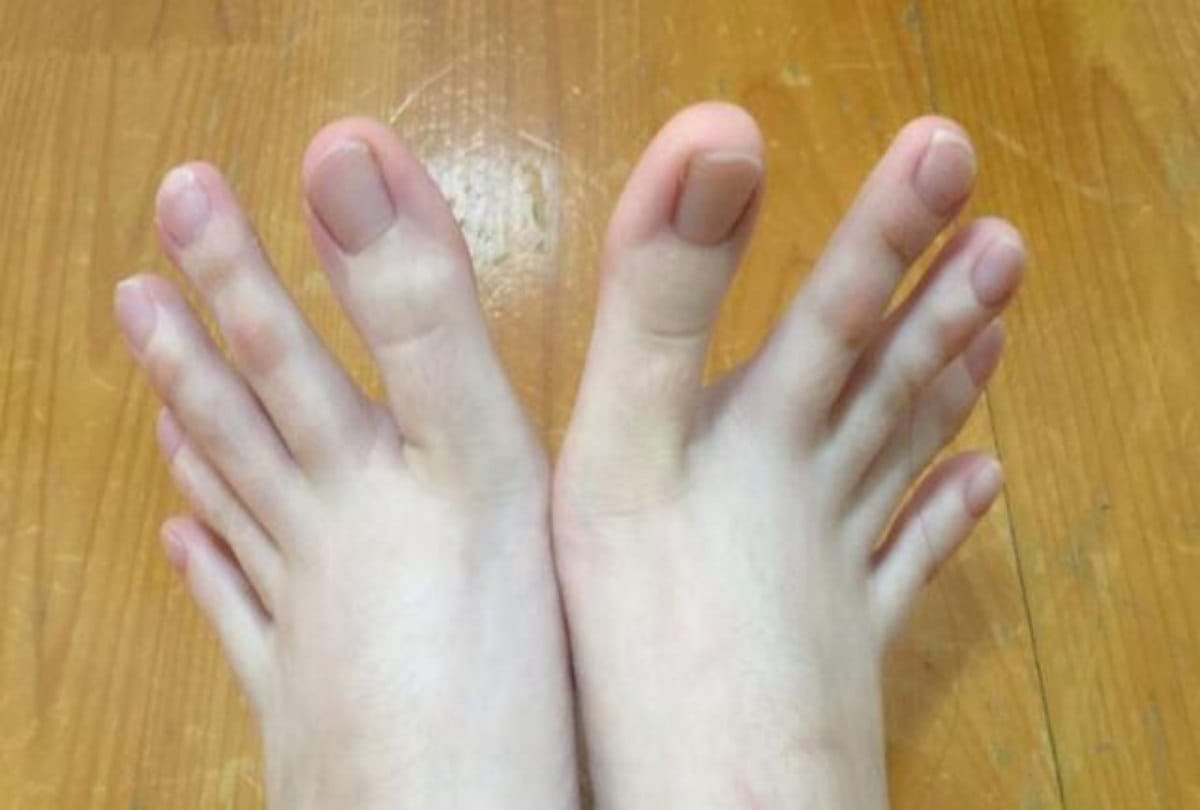 know about marks on your body determine your luck