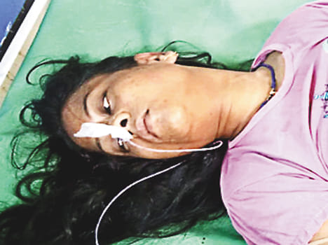 Husband dies in wife's stomach, severe