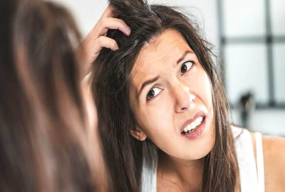home remedies for keep away dandruff in one week