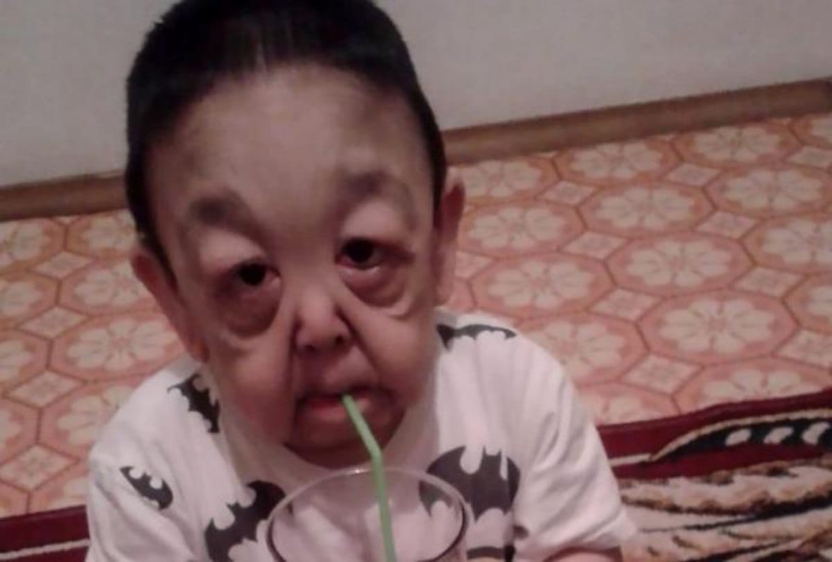 In the age of six only the boy looks like wrinkled pensioner