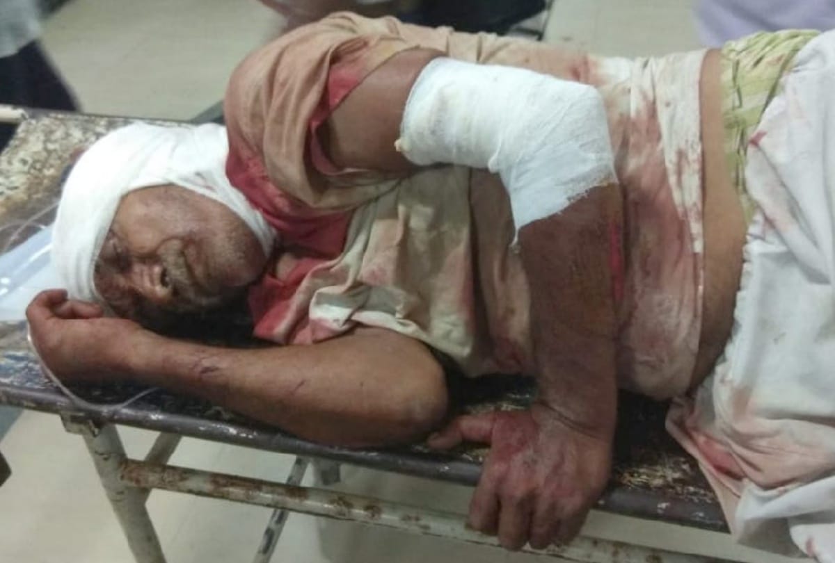 UP: man cutted saveral people with an  axe and start licking blood whole village was scared