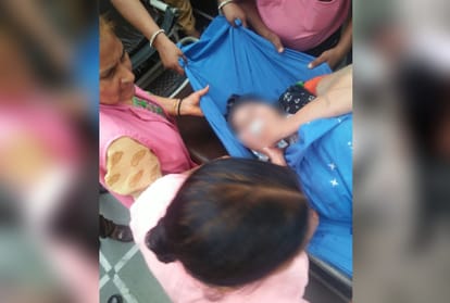 A woman suffered burn injuries after two biker allegedly threw acid on her in Ghaziabad