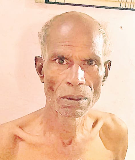 Suicide attempt by putting kerosene