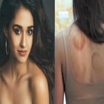 Know why Bollywood actress like disha patani are very fond of cupping therapy