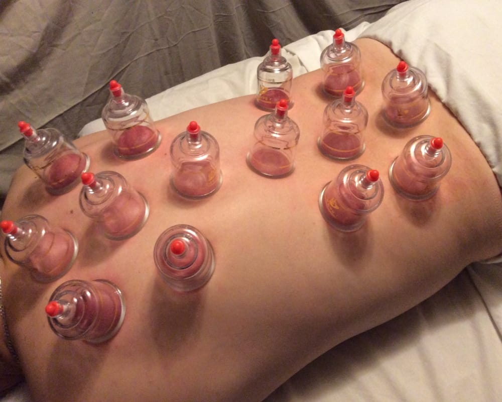 Know why Bollywood actress like disha patani are very fond of cupping therapy
