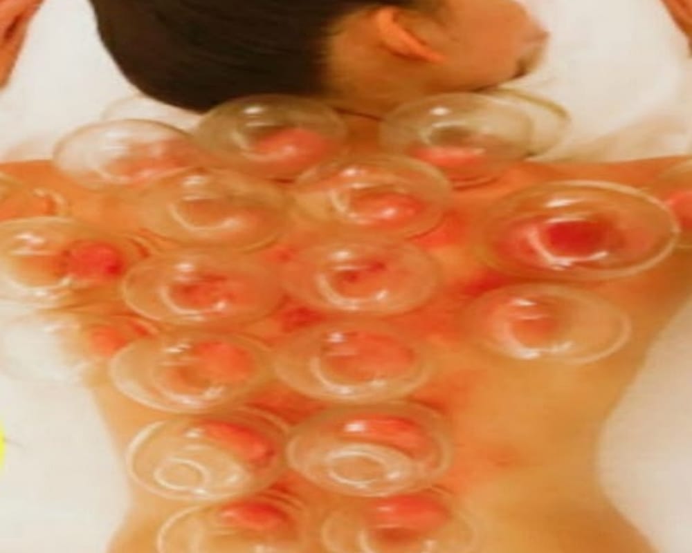 Know why Bollywood actress like disha patani are very fond of cupping therapy