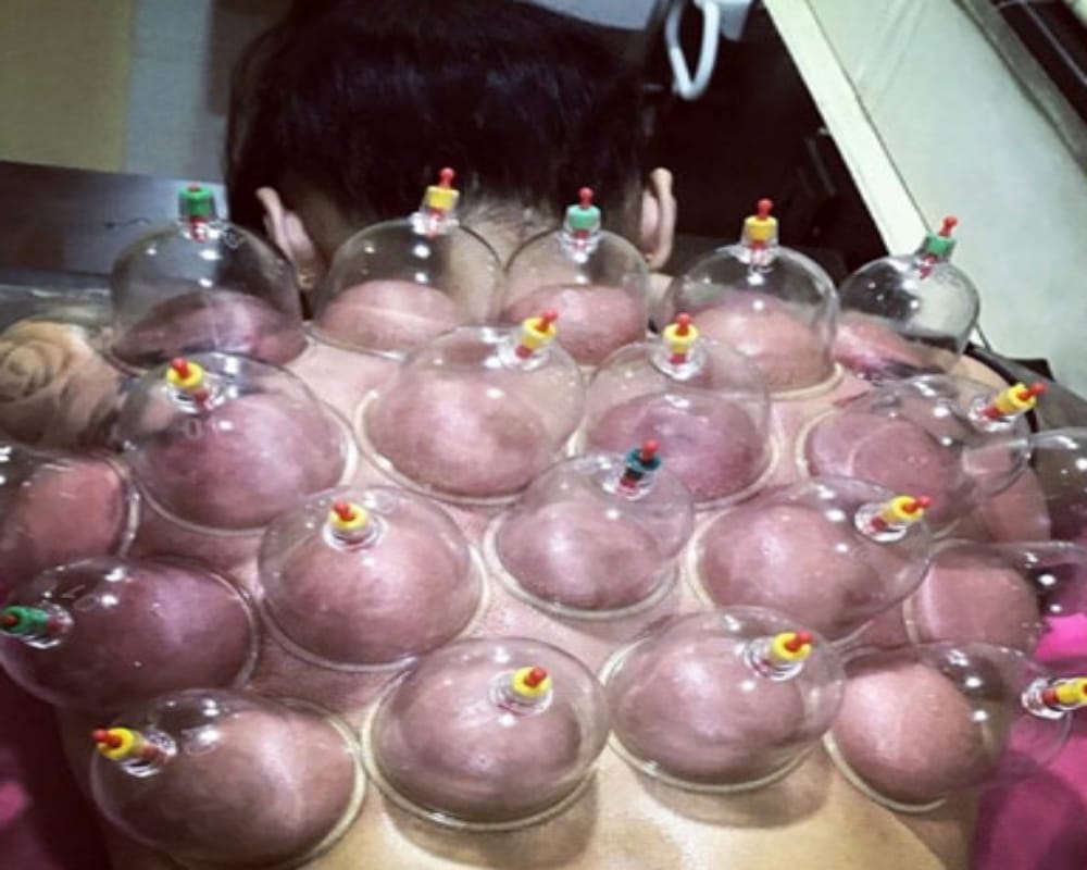 Know why Bollywood actress like disha patani are very fond of cupping therapy